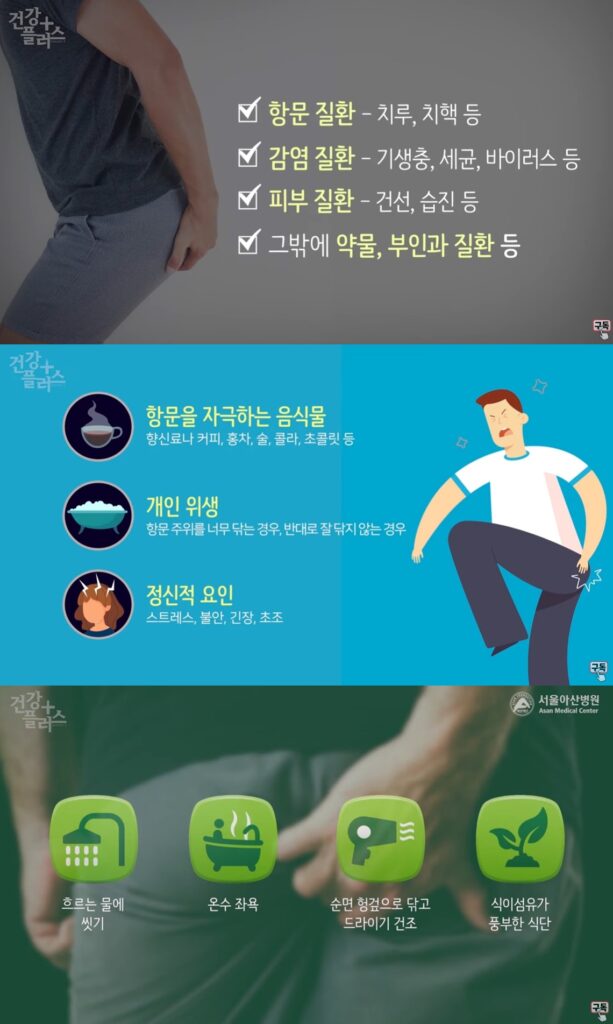 항문소양증