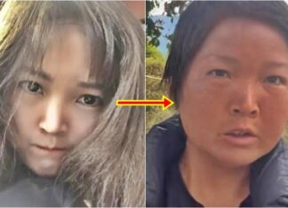 20대 얼굴이 3개월 만에 60대 할머니처럼 변한 사연