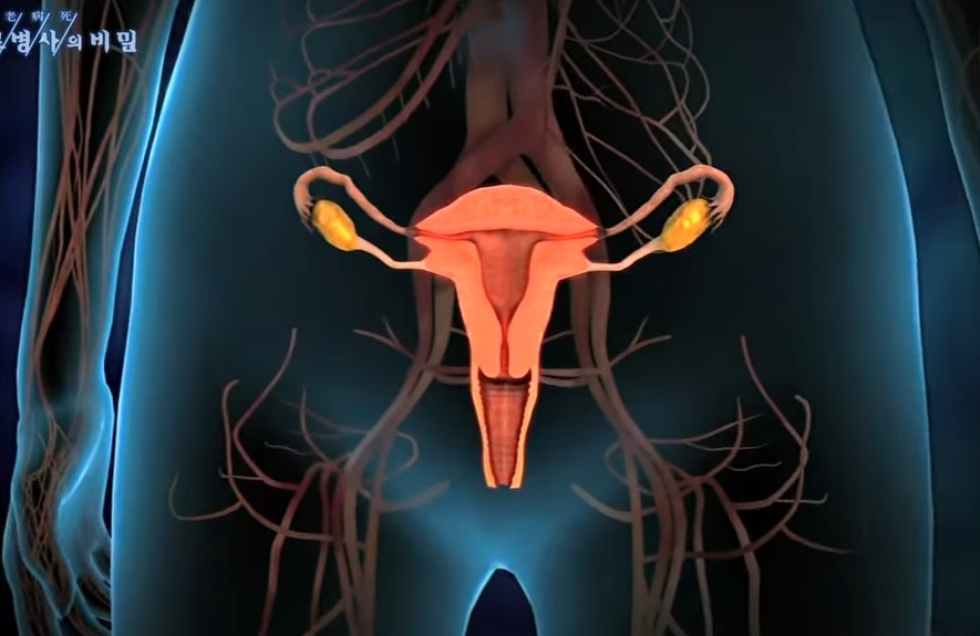자궁 생리통
