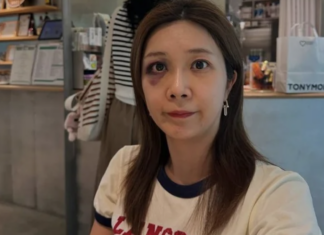 의사 남편 둔 이정민, 얼굴에 피멍 든 이유