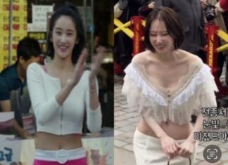 전종서 골반 수술 의혹…전후 사진 보니