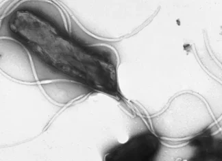 국내 감염률 50% 넘는 ‘이것’ 치매 3배 더 잘 걸리게 한다 헬리코박터균