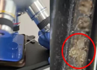 “먼지 진드기, 득실득실” 스마트폰, 현미경으로 확대하자 ‘경악’