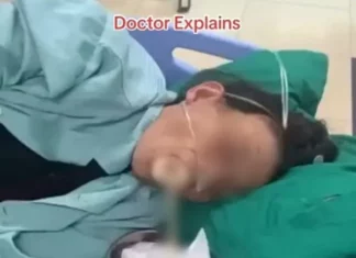 내시경 받던 여성 입에서 실 뽑듯 나온 ‘이것’…의사가 올린 충격 영상