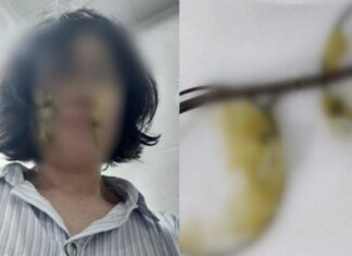 똥기저귀로 교사 얼굴 때린 학부모, 법 앞에선 “기회 주세요” 울먹
