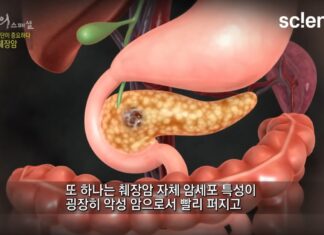 췌장암 실험에서 ‘이것’ 하나 바꿨더니 엄청난 효과 나타났다 췌장암