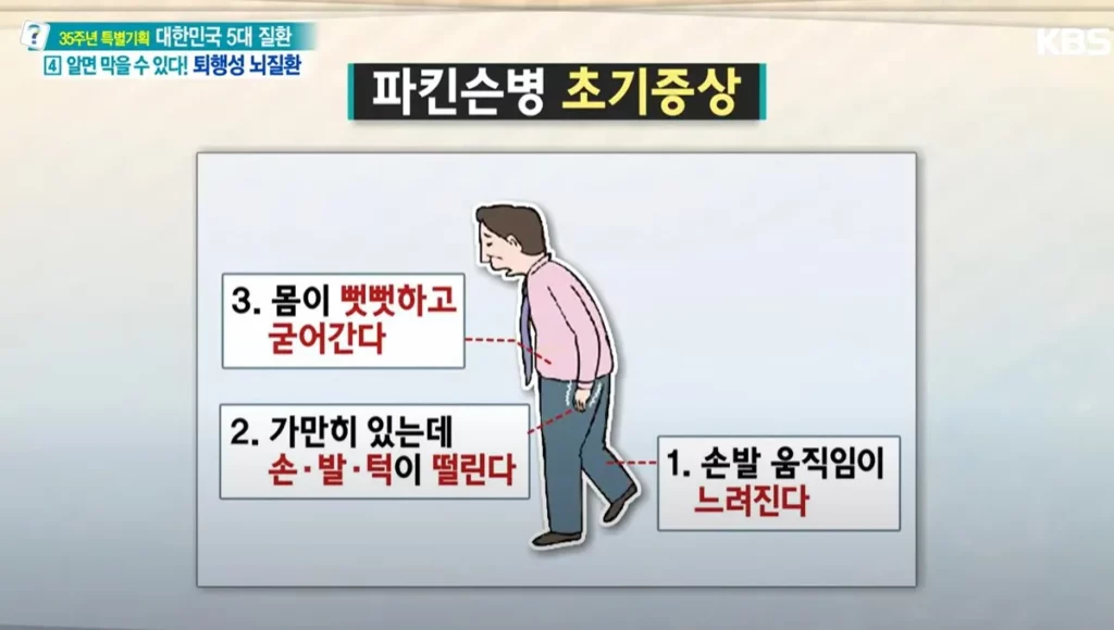 파킨슨병