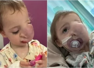 병원 데려갔다가 아동학대로 의심받은 아기 얼굴