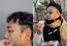 김수용 심정지 중환자실 입원 후 재조명된 심각한 귓볼 주름 김수용