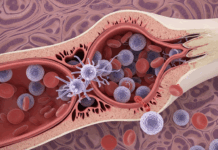 국민배우 안성기가 투병중인 혈액암은 어떤병?