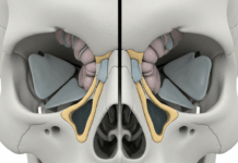 “감기인 줄 알았는데”…희귀암 ‘부비동암’, 조기 발견이 생명 좌우