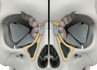 “감기인 줄 알았는데”…희귀암 ‘부비동암’, 조기 발견이 생명 좌우